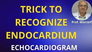 Trick to Avoid Pitfalls in Tracing LV Endocardium [upl. by Devine]