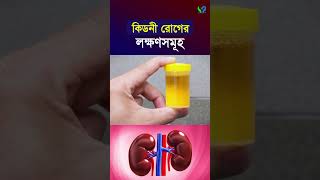 কিডনী রোগে যেসব লক্ষণ দেখা যায় । Symptomps of kidney disease [upl. by Eendyc]