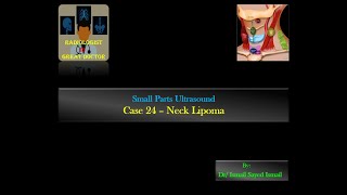 Ultrasound Case 24  Neck Lipoma [upl. by Scribner]