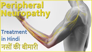 PERIPHERAL NEUROPATHIC PAIN IN HINDI what is peripheral neuropathy what can be done about it [upl. by Nylrebmik991]