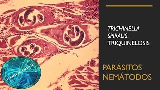 Trichinella Spiralis Triquinelosis Parásitos nemátodos [upl. by Mahseh]