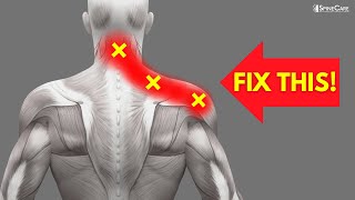 How to INSTANTLY Fix Pinched Nerve Pain in the Neck and Shoulders [upl. by Ohaus]