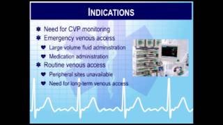 Critical Care Paramedic 7 Hemodynamic and Cardiac Monitoring [upl. by Earle226]