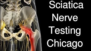 Sciatica Nerve Test Chicago [upl. by Dnivra]