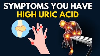 Symptoms of High Uric Acid Levels In The Body  Gout Symptoms Hyperuricemia uricacid [upl. by Hardigg590]