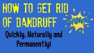 How to Get Rid of Dandruff Today  Quick Tips for Getting Rid of Dandruff Naturally [upl. by Ytisahcal]