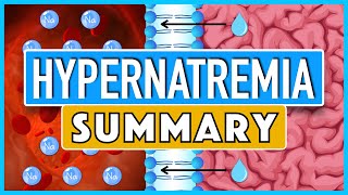 Hypernatremia Summary [upl. by Akkeber]