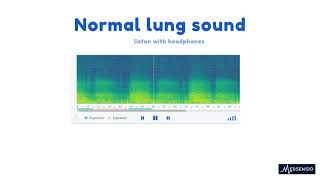 Normal lung sound [upl. by Weight543]