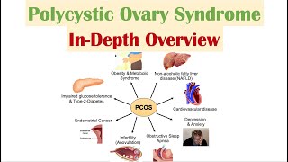 Polycystic Ovary Syndrome PCOS  Overview of Associated Conditions Diagnosis amp Treatments [upl. by Saint]