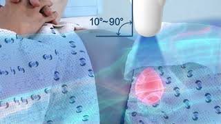 Theory of Badder Scanning  How to perform a bladder scan [upl. by Carboni]