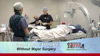 Mild Procedure at Southeastern Spine Instutitute [upl. by Jamnis]