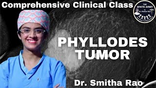 Phyllodes Tumor Case Presentation [upl. by Anma473]