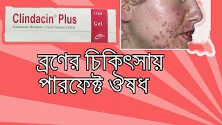 Clindacin Plus Gel  what is clindamycin gel used to treat Bangla [upl. by Elleret]