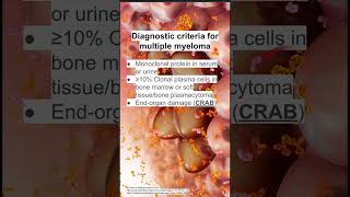 Diagnostic criteria for multiple myeloma [upl. by Enylcaj]