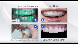 The Additive Reductive Template ART StepByStep Process  DenMat Dental Lab [upl. by Cira]