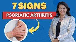 Psoriatic Arthritis 7 Signs and Symptoms  A Rheumatologist Review [upl. by Tamera]