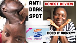 Palmer’s Skin Success Fade Cream Honest Review Dark Spot and Eventone Face Cream [upl. by Ecyob]