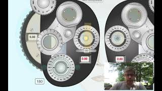 Retinoscopy with Refracting Instrument Minus cylinder [upl. by Oisor]