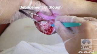 Explanation of Wound Dressings by Skilled Wound Care Dr Bardia Anvar MD [upl. by Arekahs]