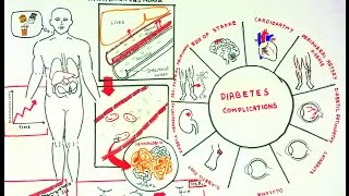 Advanced Glycosylation End Products and Diabeteic complications [upl. by Gifferd]