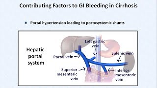 Esophageal Varices and Variceal Hemorrhage [upl. by Pickard]