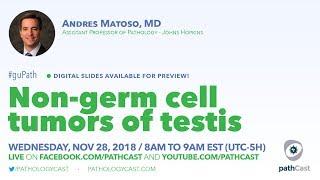 Nongerm cell tumor of testis  Dr Matoso Hopkins GUPATH [upl. by Onaicul215]