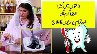 Teeth Plaque removal  Teeth whitening by Dr Bilquis Shaikh [upl. by Hayimas]