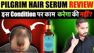 Pilgrim Advanced Hair Growth Serum Review  Genuine Tips [upl. by Tobi812]