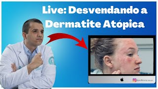 Live Dermatite Atópica  Causas Sintomas e Tratamentos com Dr Bruno Souza [upl. by Philipp829]