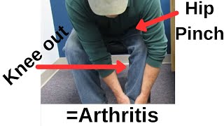 Classic Sign of Hip ArthritisThis is the SIMPLEST test to identify it [upl. by Tamera]