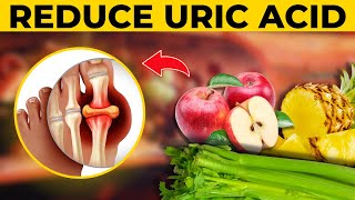 Foods To Avoid If You Have High Uric Acid Levels  Aarogyamastu  5th Aug 2022  ETV Life [upl. by Fanchon201]