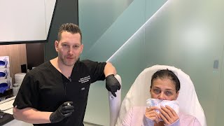 Female Facial Sculpting with Belotero  Smokers Lines and Lip Rejuvenation  West Hollywood CA [upl. by Hsan564]