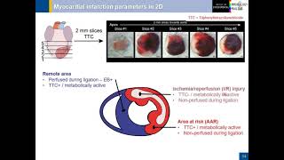 Quantitative 3D Assessment of Myocardial IschemiaReperfusion Injury and Response [upl. by Nosnorb]