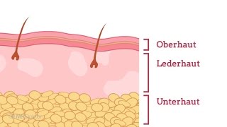 Wie entsteht Neurodermitis  NetDoktorde [upl. by Alurd]