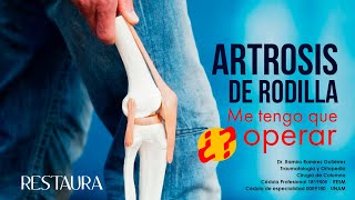 Artrosis de Rodilla ¿Me tengo que operar [upl. by Anetsirk]