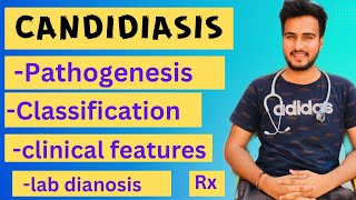 Candidiasis microbiologypathogenesislabdiagnosisTreatment [upl. by Notlit]