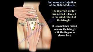 Deltoid Intramuscular injection  Everything You Need To Know  Dr Nabil Ebraheim [upl. by Nomolos]