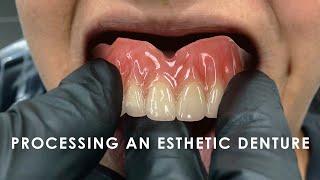 How to Process an Esthetic Denture [upl. by Zaller]