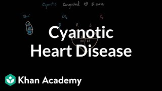 What is cyanotic heart disease  Circulatory System and Disease  NCLEXRN  Khan Academy [upl. by Enyak]