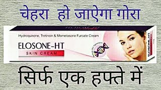 Elosone HT Cream Review Side Effects UsesBest Fairness Cream For Marks [upl. by Jacquelyn]