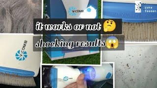 Vcomb Anti lice Machine Unboxing Price Review amp How to use Complete Guide and honest review [upl. by Oreves]