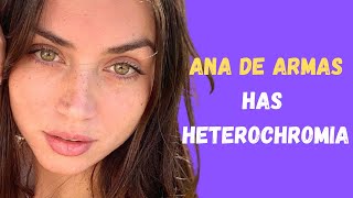 Ana de Armas Fun Facts  She Has Central Heterochromia shorts [upl. by Zacarias970]