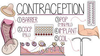 Methods of Contraception Made Easy Contraceptive Methods Explained [upl. by Dustin790]