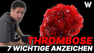 Lebensgefahr Thrombose 7 Warnzeichen und wichtige Tipps gegen Thrombosen [upl. by Atiuqal]