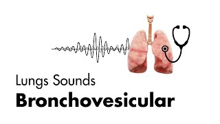 Bronchovesicular Breath Sounds  Lung Sounds  MEDZCOOL [upl. by Nakashima]