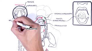 Stridor in children causes inspiratory and expiratory stridor pathophysiology [upl. by Llien346]