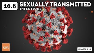 IGCSE Biology  Sexually transmitted infections 166 [upl. by Mcintyre877]