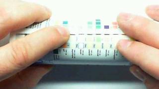 Urinalysis Part 1mp4 [upl. by Anorahs]