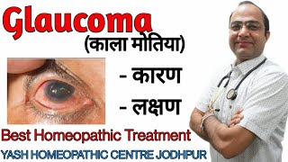 Glaucoma गलूकोमा।काला मोतिया  cause symptoms and homeopathic treatment without surgery [upl. by Fiann]