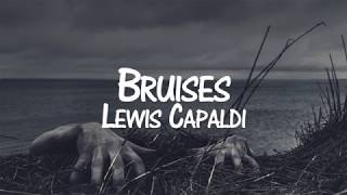 Lewis Capaldi  Bruises Sub Español [upl. by Noraed773]